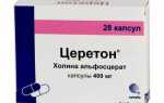 Что лучше селерон или пентиум