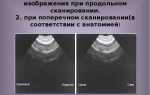 Почему при сканировании появляются полосы