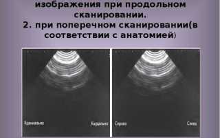 Почему при сканировании появляются полосы