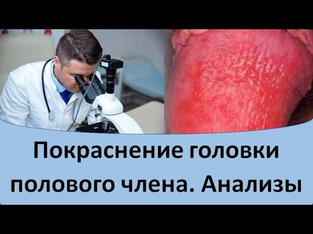 Проверка наличия резервных копий Office на ПК