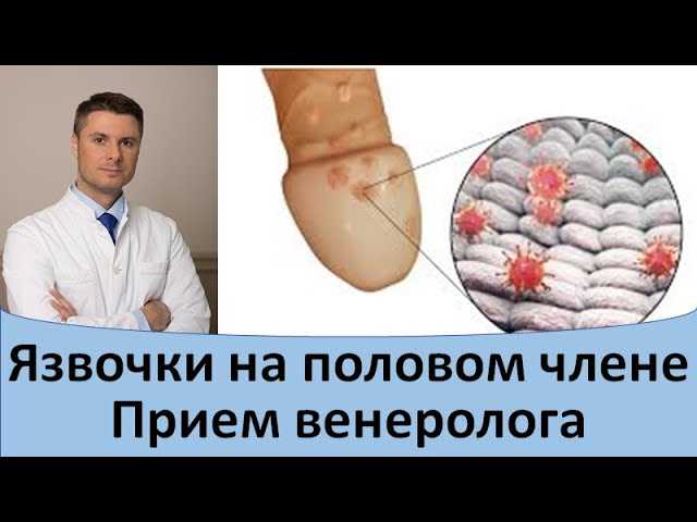 Исправление ошибок запуска Office после восстановления