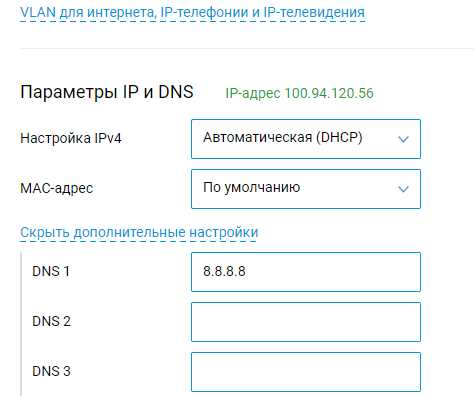 Слэш в конфигурации DHCP и статических IP