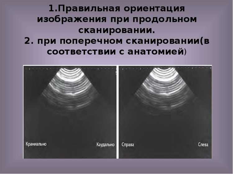 Почему при сканировании появляются полосы Почему при сканировании появляются полосы